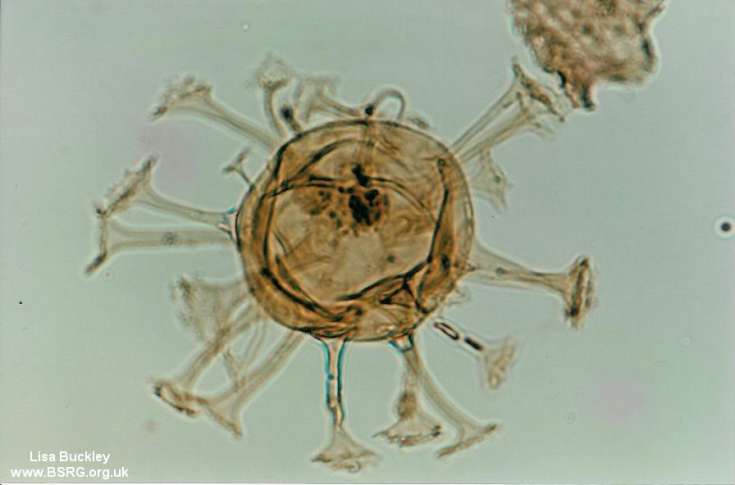 Hystrichosphaeridia tubiferum, paleogene dinoflagellate, Beryl Field, North Sea.